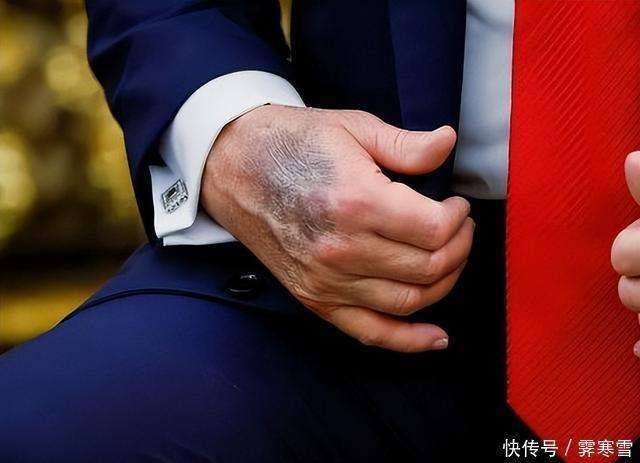 特朗普回应健康质疑