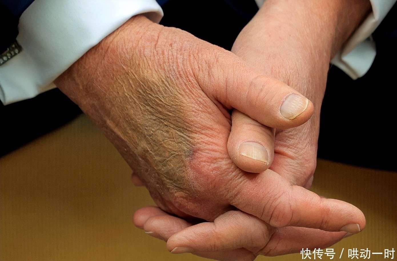 特朗普回应健康质疑