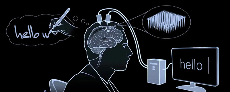 中国速度碾压马斯克！脑机接口企业临床植入总例数有望年底迈向全球第一